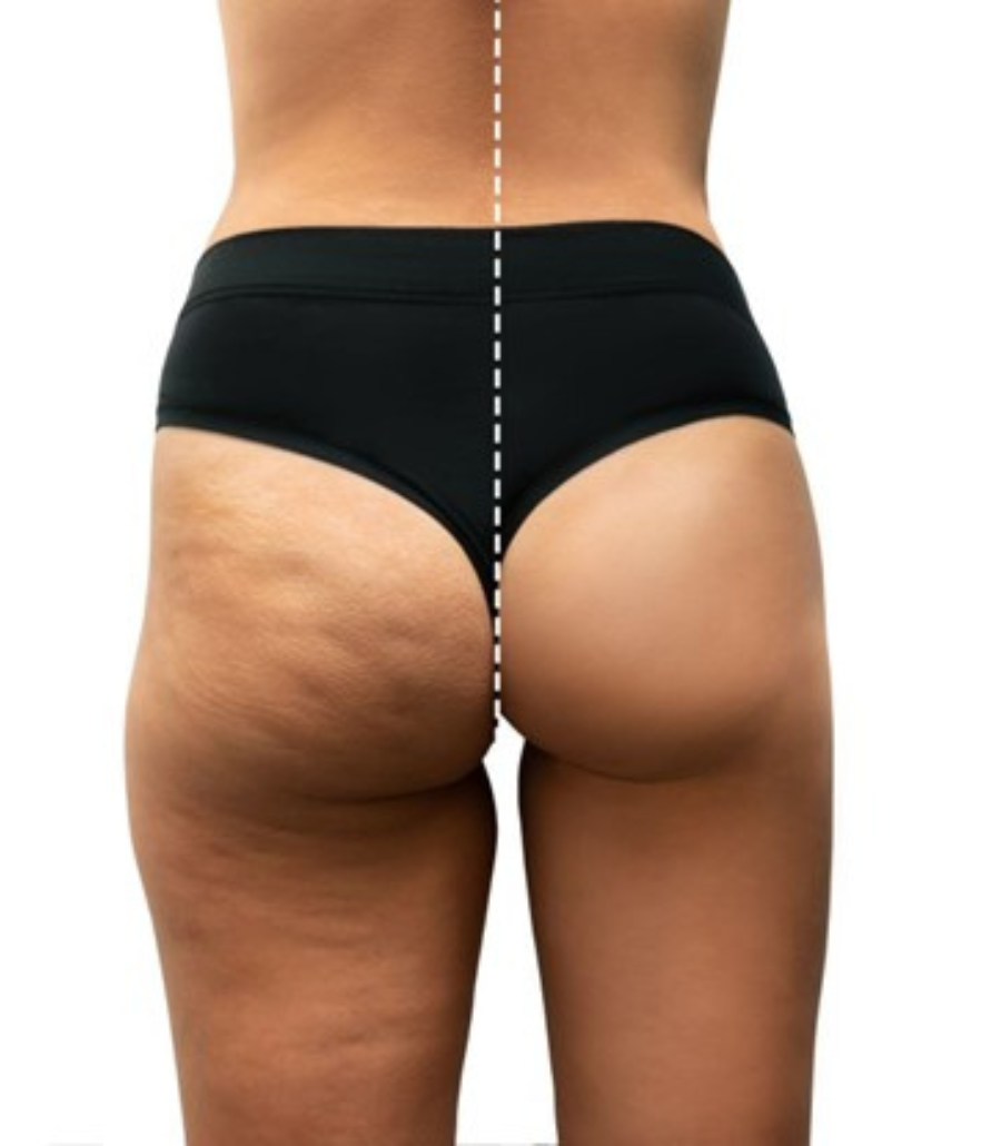 T-Shape 2 Body (LL)